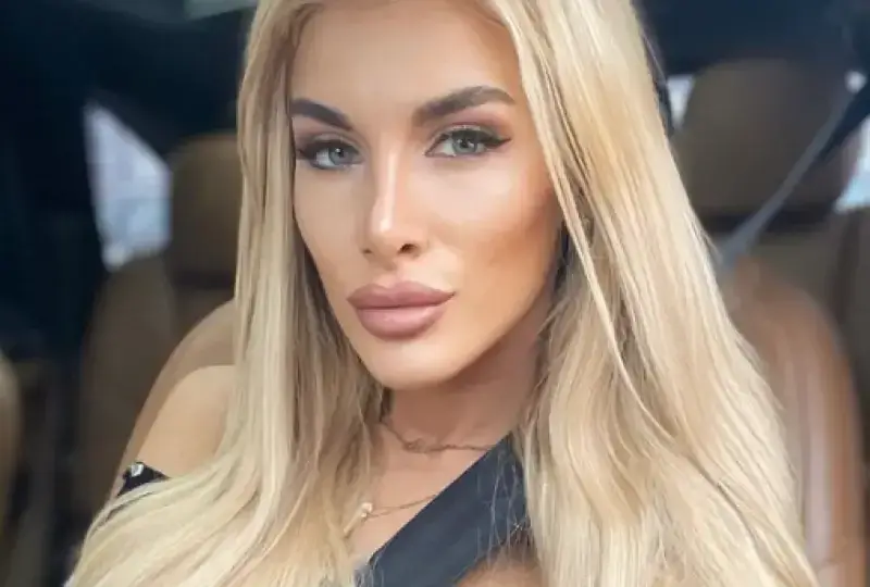 Зарязаната Мис Нос се закачи за нов милионер