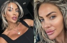 Русата Златка си направи гигантска уста, ще я ползва като полов орган СНИМКИ