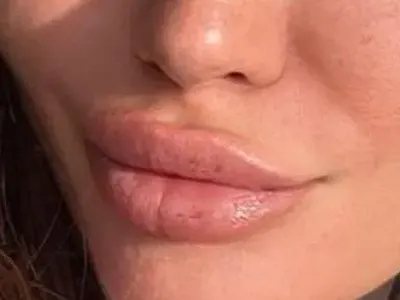 Ади, защо гърбът ти е на бюста?! Щерката на Фатик със спешна нужда от силикон!