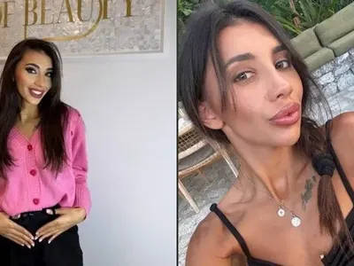 АЙ, ХАИРЛИЯ ДА Е!! Цър-Пър от „Ергенът“ най-сетне показа новия си нос: Виктория е неузнаваема! (СНИМКИ)