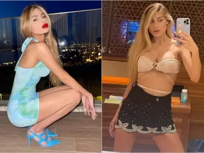 Анорексия докарва риалити звезда до 22 кг и я убива