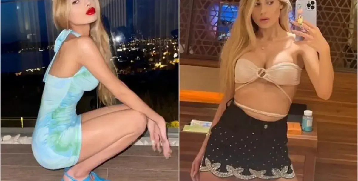 Анорексия докарва риалити звезда до 22 кг и я убива
