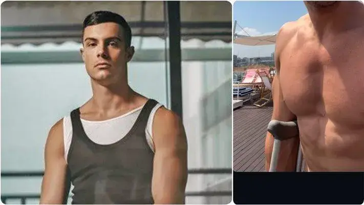 Филип Буков играе с патерици