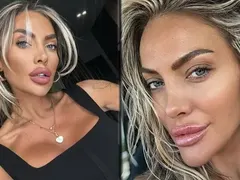 Русата Златка си направи гигантска уста, ще я ползва като полов орган СНИМКИ