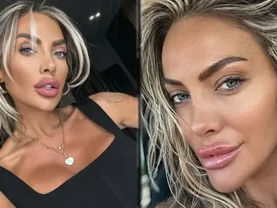 Русата Златка си направи гигантска уста, ще я ползва като полов орган СНИМКИ