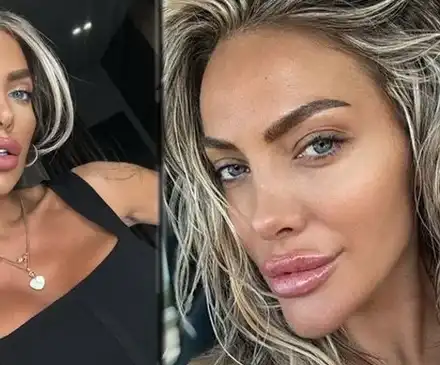 Русата Златка си направи гигантска уста, ще я ползва като полов орган СНИМКИ