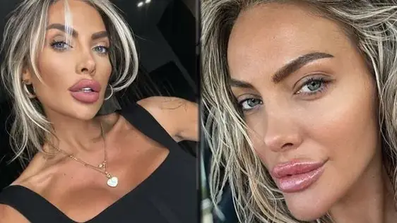 Русата Златка си направи гигантска уста, ще я ползва като полов орган СНИМКИ