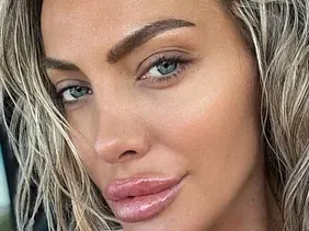 Русата Златка си направи гигантска уста, ще я ползва като полов орган СНИМКИ