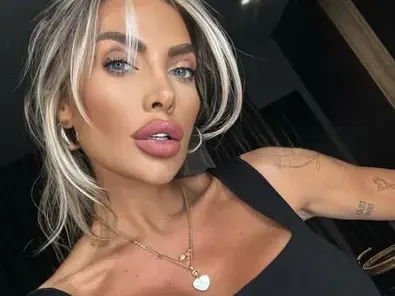 Русата Златка си направи гигантска уста, ще я ползва като полов орган СНИМКИ