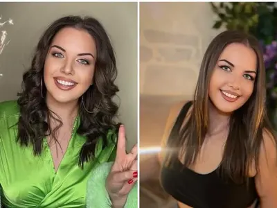 Веселка пропищя от неуспешна операция в Турция! Шефът на болницата я вкарал и в любовна измама