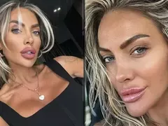 Русата Златка си направи гигантска уста, ще я ползва като полов орган СНИМКИ