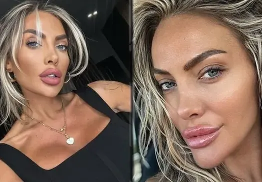 Русата Златка си направи гигантска уста, ще я ползва като полов орган СНИМКИ