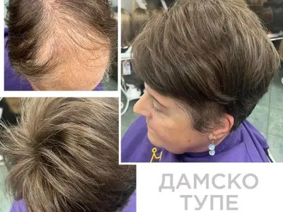 За самочувствие и стил: Магама предлага пълна гама от дамски и мъжки тупета