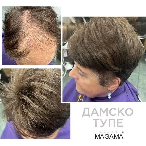 За самочувствие и стил: Магама предлага пълна гама от дамски и мъжки тупета