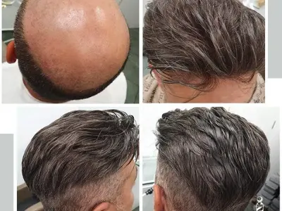 За самочувствие и стил: Магама предлага пълна гама от дамски и мъжки тупета