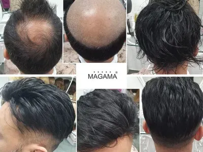 За самочувствие и стил: Магама предлага пълна гама от дамски и мъжки тупета