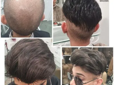 За самочувствие и стил: Магама предлага пълна гама от дамски и мъжки тупета