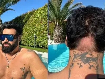 Азис със стряскаща снимка на опадалата си коса