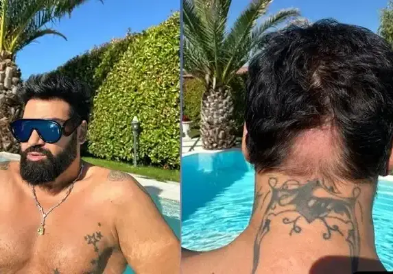 Азис със стряскаща снимка на опадалата си коса