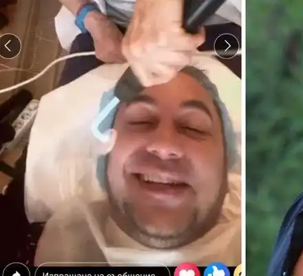 Коцето се подмладява с лазерни процедури