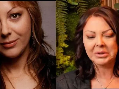 Кой е хирургът, обезобразил Ани Владимирова? (Шокиращи кадри)