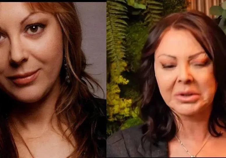 Кой е хирургът, обезобразил Ани Владимирова? (Шокиращи кадри)