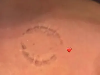 ТРУС!! Християн Гущеров си хвана МАДАМА-ЗВЯР: Заведе я на Халкидики и показа белези от зъбите й по тялото си! (ШОК СНИМКИ)