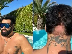 Азис със стряскаща снимка на опадалата си коса