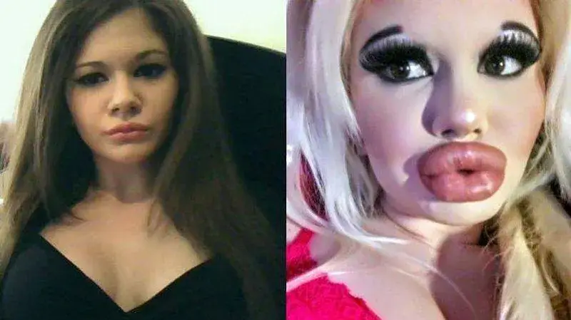 Да се превърнеш в ЧУДОВИЩЕ: БГ Барби преди и сега (Снимки)