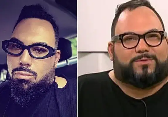 Мон Дьо отслабна с 40 кг без операция! Вижте как!