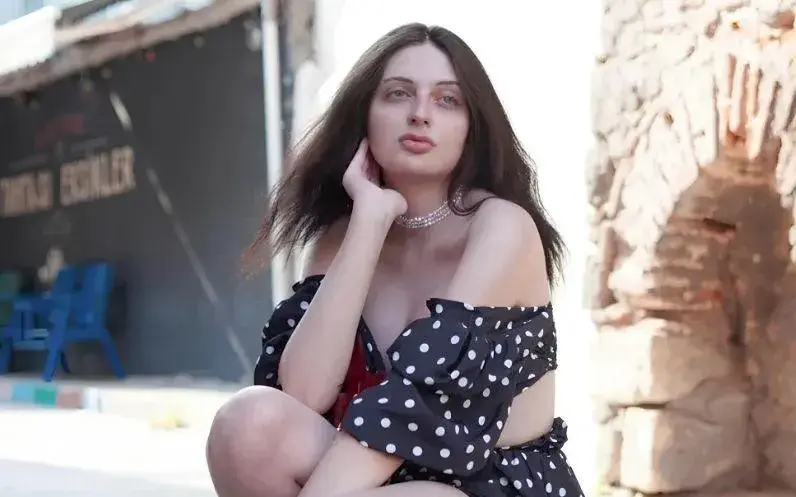 Петра с нов нос! Транссексуалната сменя визията