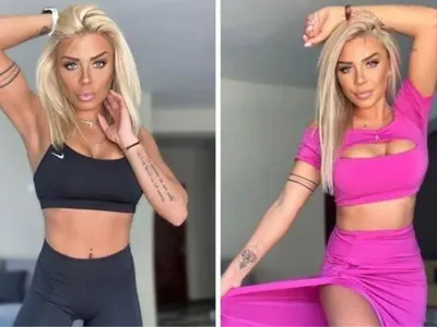 Денислава от „Игри на волята“ разкри как се лекува