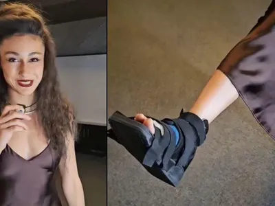 Керана шокира с гипсиран крак преди концерта в Пловдив!