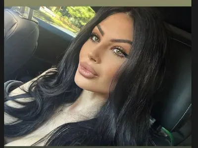 Скандал! Мис България разкрива ново носле - Вижте преди и след!