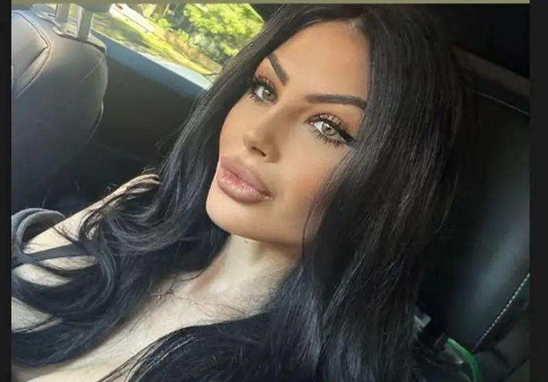 Скандал! Мис България разкрива ново носле - Вижте преди и след!