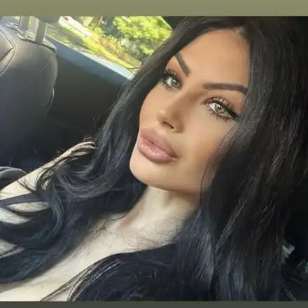 Скандал! Мис България разкрива ново носле - Вижте преди и след!