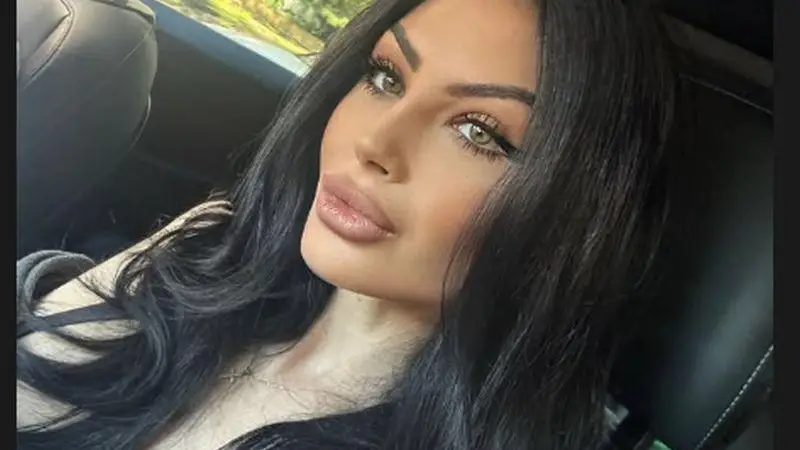 Скандал! Мис България разкрива ново носле - Вижте преди и след!