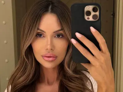 Моника Валериева шокира с първия си филър! Вижте къде го сложи!