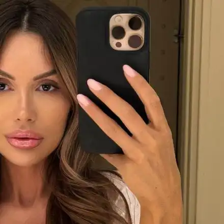 Моника Валериева шокира с първия си филър! Вижте къде го сложи!