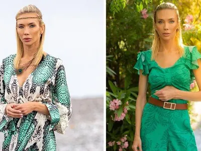 Шокираща трансформация на Райна Караянева! Какво се крие зад лицето й?