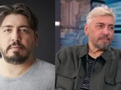 5 бона за перфектен корем: Геро се подлага на абдоминопластика