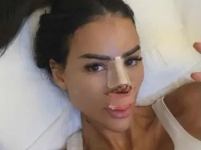 Благо и Мария Луиза: Ринопластика на двойки – нова мода в София!