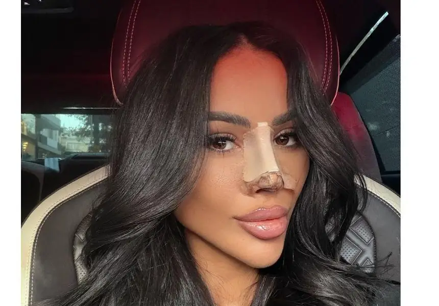 Шок! Гаджето на Джийза отново под ножа – какво се случи?