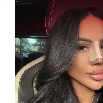 Шок! Гаджето на Джийза отново под ножа – какво се случи?