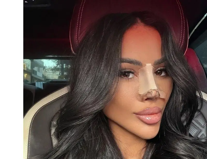 Шок! Гаджето на Джийза отново под ножа – какво се случи?