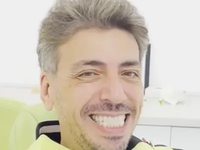 Геро шокира с нова операция! Какво следва след драстичната трансформация?