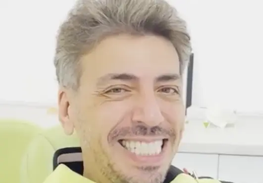 Геро шокира с нова операция! Какво следва след драстичната трансформация?