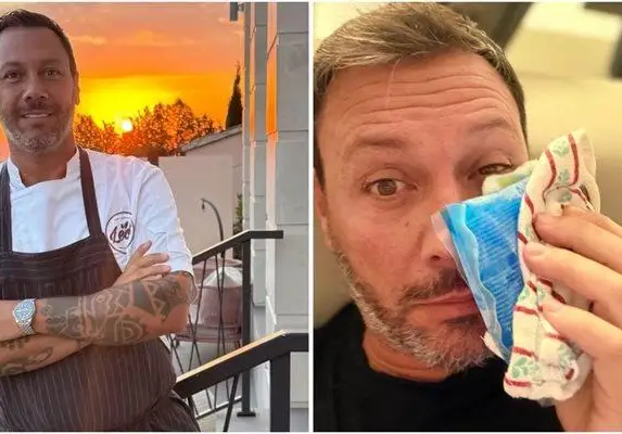 Шок! Лео Бианки с насинено око след мач в Драгалевци!