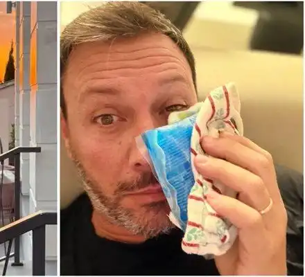 Шок! Лео Бианки с насинено око след мач в Драгалевци!