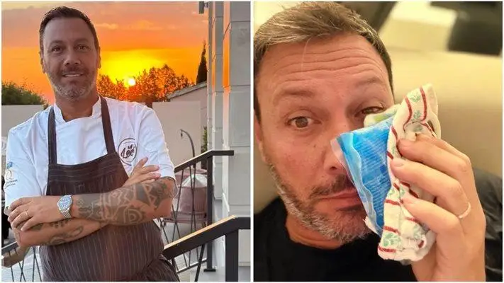 Шок! Лео Бианки с насинено око след мач в Драгалевци!